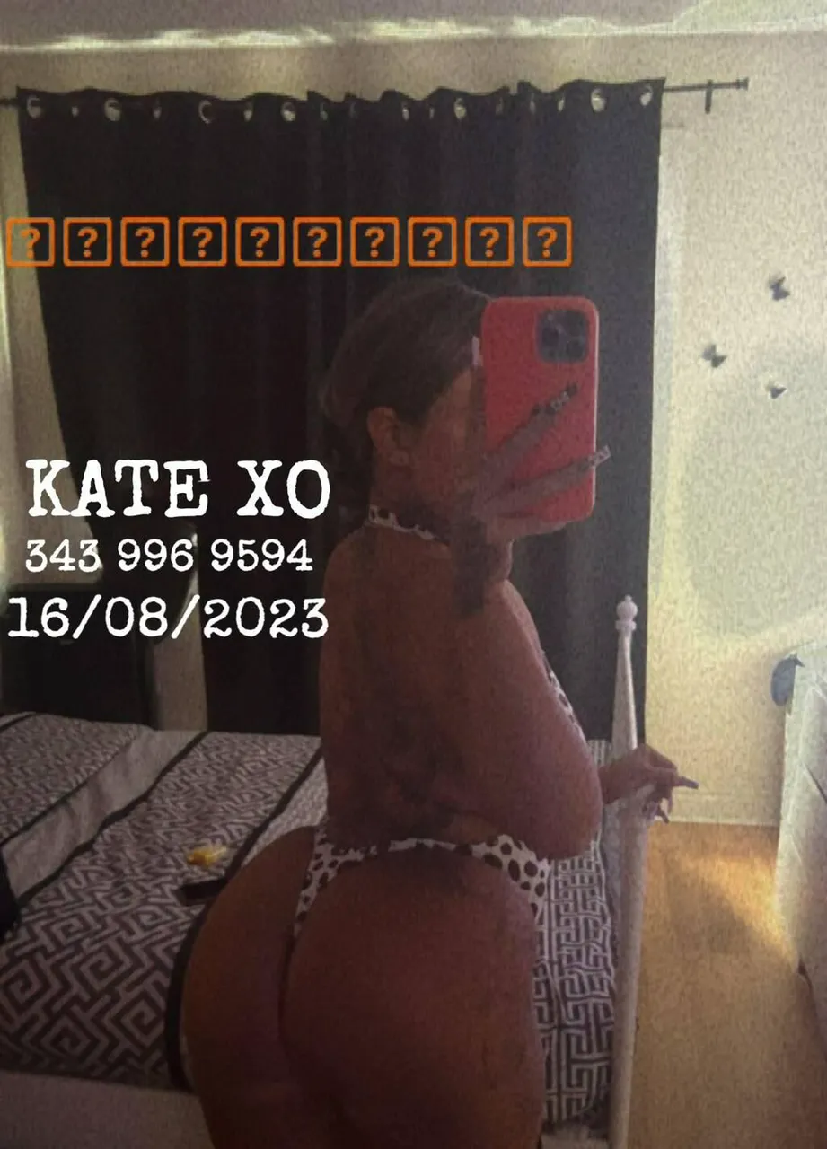 Escorts Niagara Falls, Ontario Kate Xo (Lost Contacts)