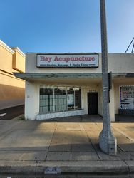 Redondo Beach, California Bay Acupressure