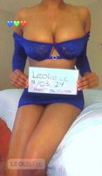 Escorts London, Ontario ★VREAL& VERIFIED★♡SWEETEST TREAT FOR YOURSELF