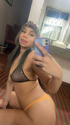 Escorts Sacramento, California HONEY 🍯